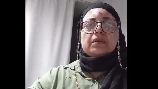إصابة مدرسة في مشاجرة مع سيدة أثناء استقلالها ميكروباص